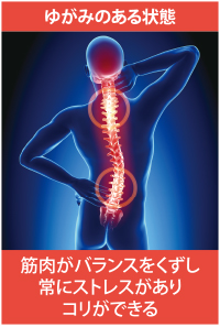 背骨・骨盤がゆがむと筋肉の張り具合がバラバラ-1